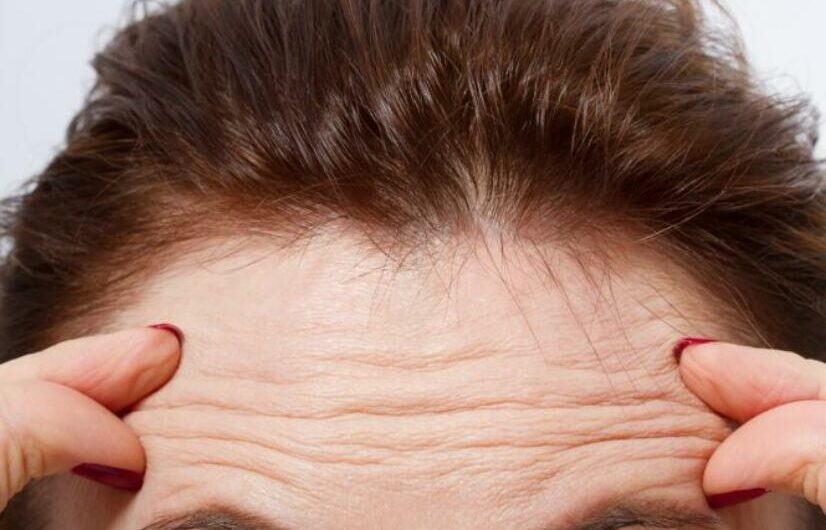 How to Get Rid of Deep Forehead Creases:16 Remedies