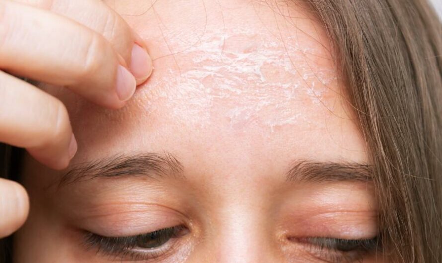 10 Effective Ways to Get Dry Flaky Skin Off the Face