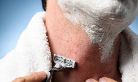 Home Remedies For Razor Bumps on Neck