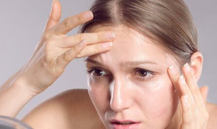 Natural Remedies to Tighten Forehead Wrinkles