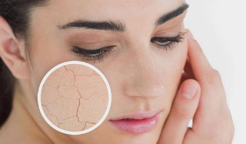 12 Common Side Effects of Dry Skin You Should Know