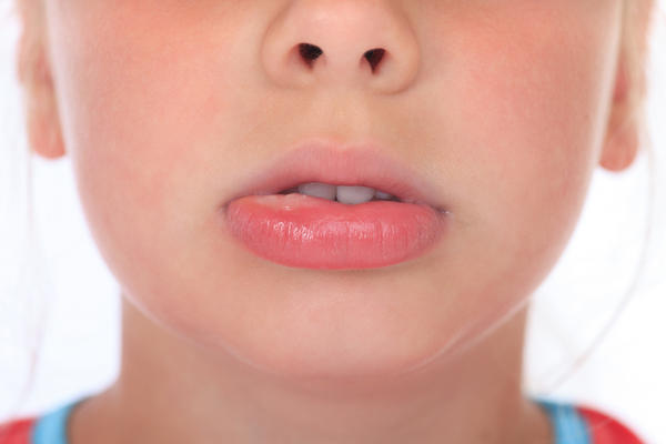 14 Causes of Wake Up with Swollen Lips with Treatment