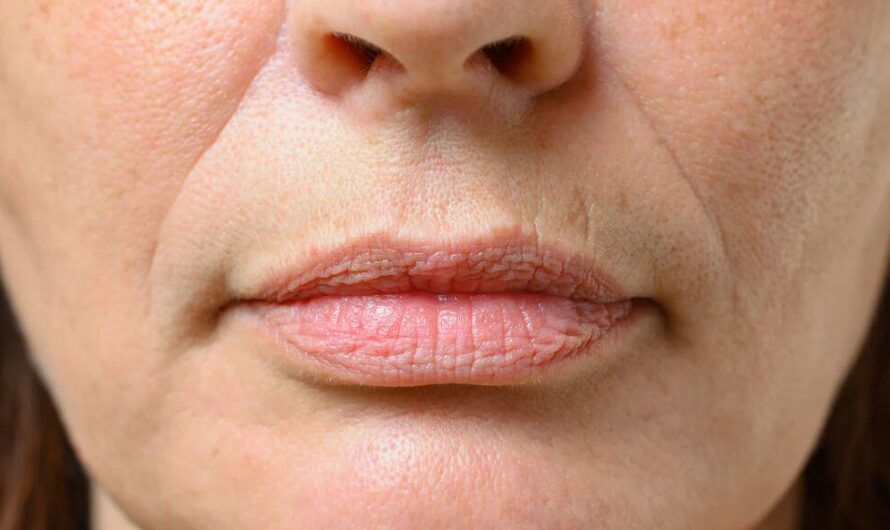14 Natural Ways to Get Rid of Wrinkles Around Mouth
