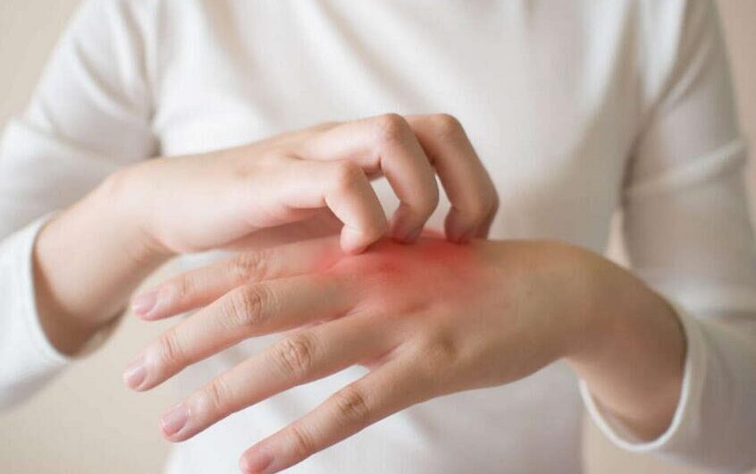 How to Stop Itching Skin Immediately:16 Easy Ways