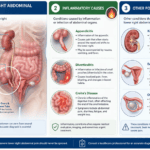 Lower Right Abdominal Pain:16 Causes & When to See a Doctor Lower Right Abdominal Pain